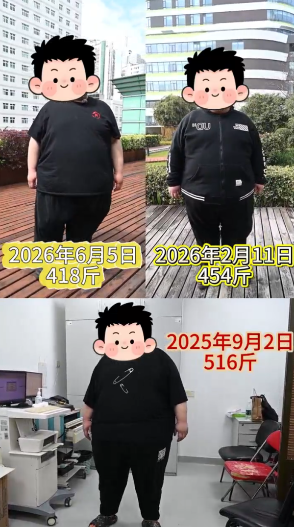 登录入口 “衣着宽松了步行狭窄了”, 仍是超500斤的他历时八个多月减重近100斤